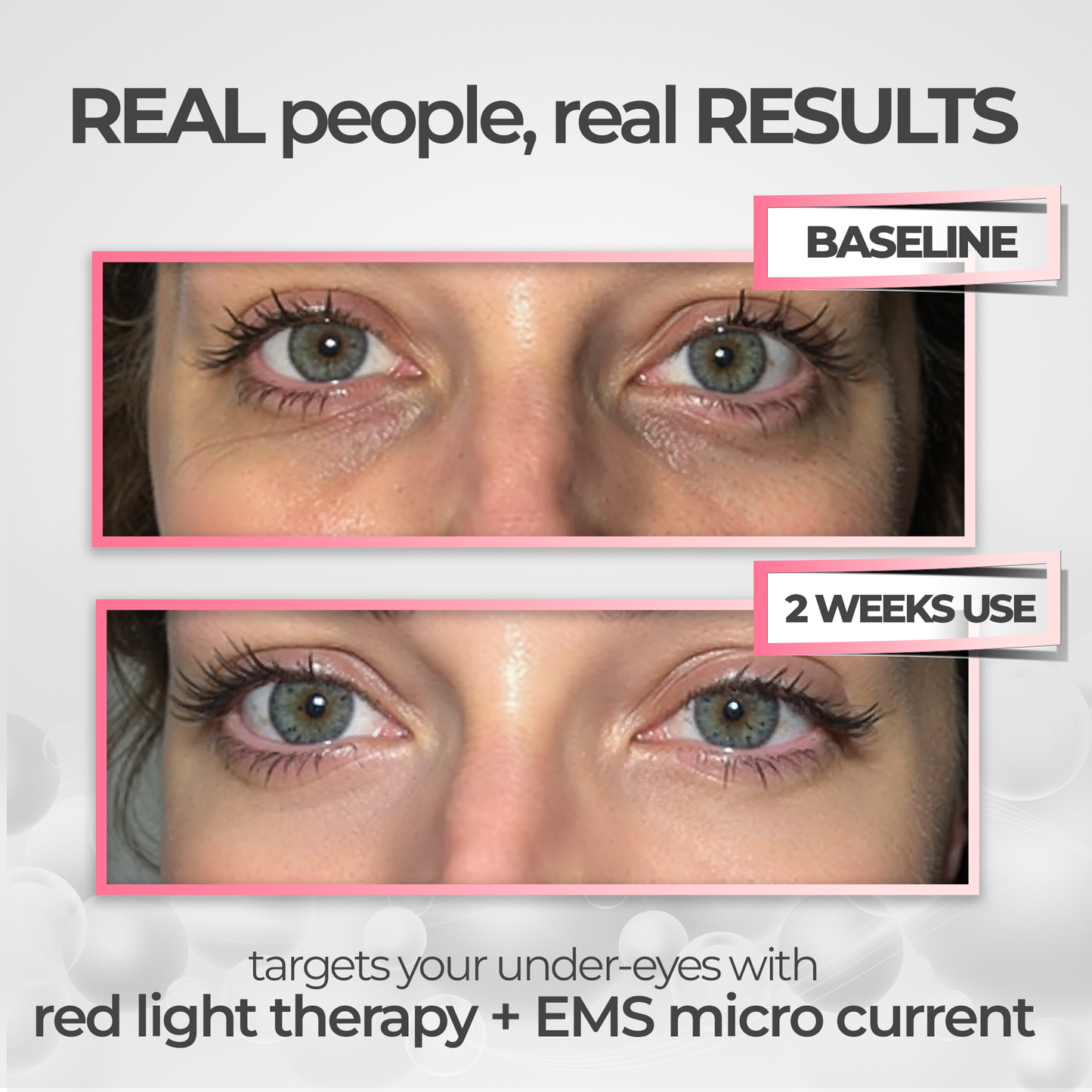 RevitalEyes™ Under-Eye Red Light Therapy